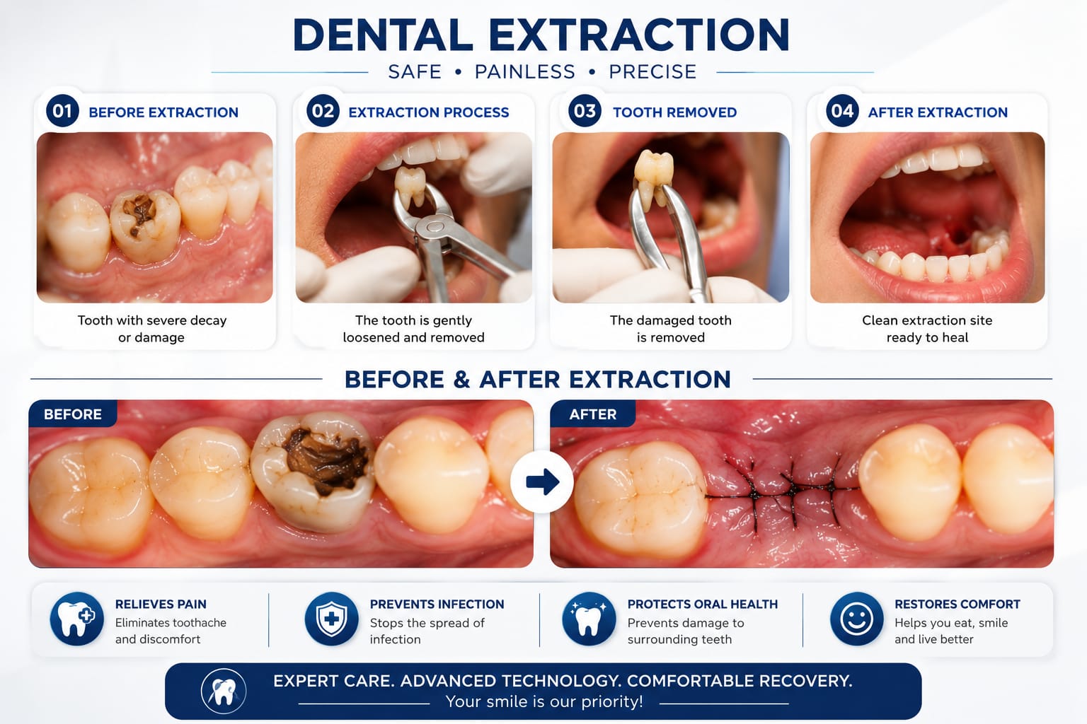 Extraction